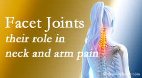 Chiropractic Solutions carefully examines, diagnoses, and treats cervical spine facet joints for neck pain relief when they are involved.