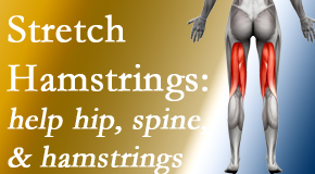 Chiropractic Solutions promotes back pain patients to stretch hamstrings for length, range of motion and flexibility to support the spine.