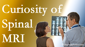 San Jose MRIs for spinal stenosis may be revealing…or confusing.