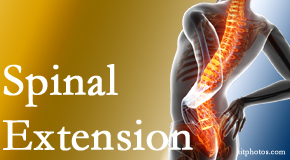 Chiropractic Solutions understands the role of extension in spinal motion, its necessity, its benefits and potential harmful effects. 