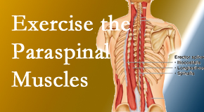 Chiropractic Solutions describes the importance of paraspinal muscles and their strength for San Jose back pain relief.