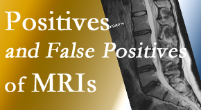 Chiropractic Solutions carefully chooses when and if MRI images are needed to guide the San Jose chiropractic treatment plan. 