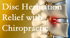 Chiropractic Solutions gently treats the disc herniation causing back pain. 