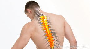 San Jose thoracic spine pain image 