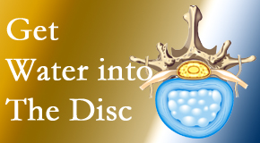 Chiropractic Solutions uses spinal manipulation and exercise to enhance the diffusion of water into the disc which helps the health of the disc.