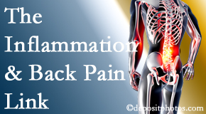 Chiropractic Solutions addresses the inflammatory process that accompanies back pain as well as the pain itself.
