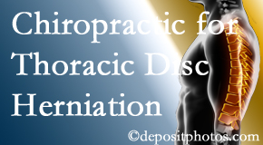 Chiropractic Solutions diagnoses and manages thoracic disc herniation pain and relieves its symptoms like unexplained abdominal pain or other gastrointestinal issues. 