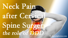 Chiropractic Solutions offers gentle treatment for neck pain after neck surgery.