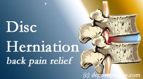 Chiropractic Solutions uses non-surgical treatment for relief of disc herniation related back pain. 