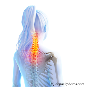 picture of San Jose neck pain relief