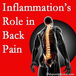 The role of inflammation in San Jose back pain is real. Chiropractic care can help.