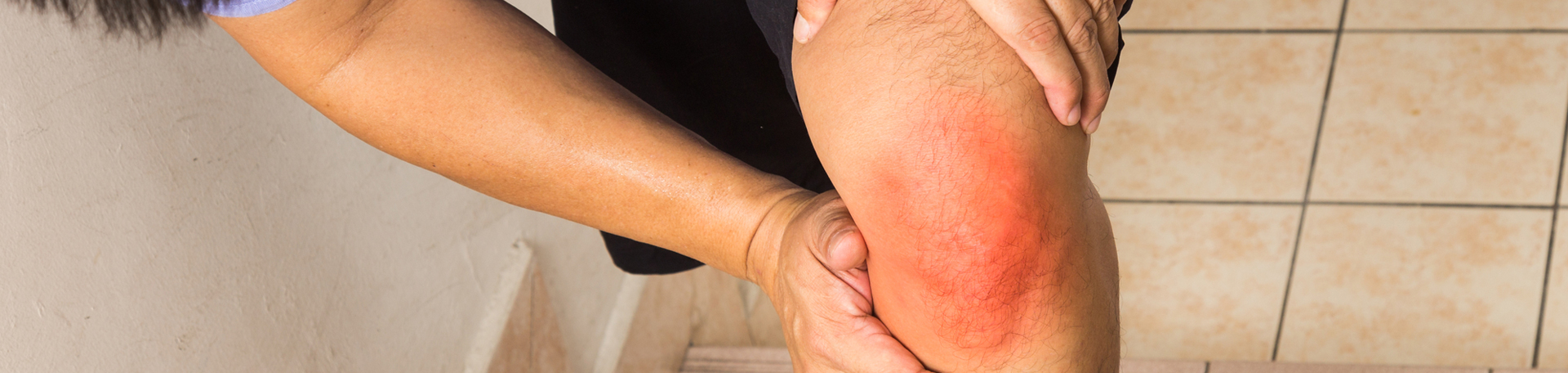 San Jose knee pain, osteoarthritis