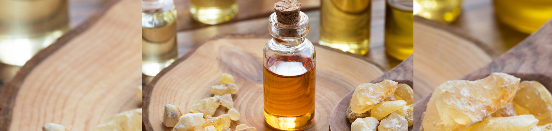 San Jose anti-inflammatory frankincense