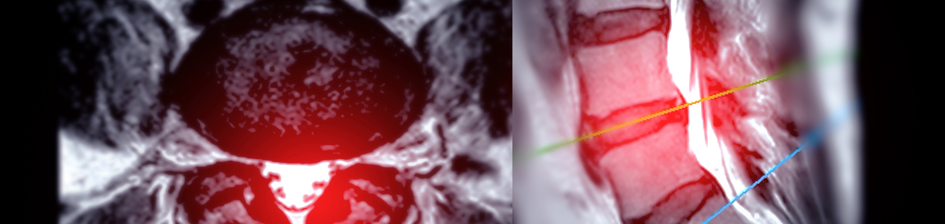 San Jose back pain imaging and exercise