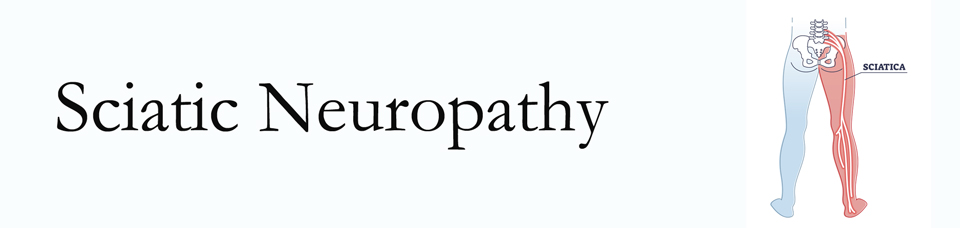 San Jose neuropathy pain (sciatica) 