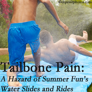 Chiropractic Solutions uses chiropractic manipulation to ease tailbone pain after a San Jose water ride or water slide injury to the coccyx.