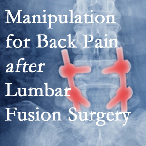 San Jose chiropractic spinal manipulation helps post-surgical continued back pain patients discover relief of their pain despite fusion. 