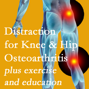 A chiropractic treatment plan for San Jose knee pain and hip pain due to osteoarthritis: education, exercise, distraction.