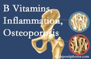 San Jose chiropractic care of osteoporosis often comes with nutritional tips like b vitamins for inflammation reduction and for prevention.