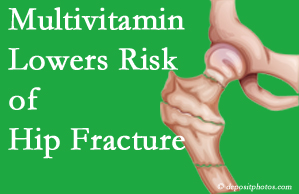 San Jose hip fracture risk is reduced by multivitamin supplementation. 