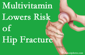 San Jose hip fracture risk is reduced by multivitamin supplementation.