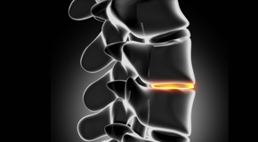 San Jose chiropractic nutrition with vitamin D and quercitrin