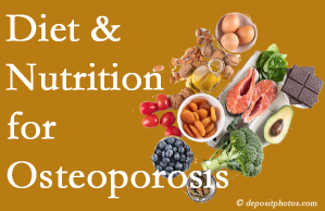 San Jose osteoporosis prevention tips from your chiropractor include improved diet and nutrition and reduced sodium, bad fats, and sugar intake. 