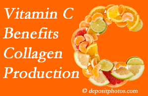 San Jose chiropractic offers tips on nutrition like vitamin C for boosting collagen production that decreases in musculoskeletal conditions.