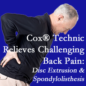 San Jose chiropractic care with Cox Technic relieves back pain due to a painful combination of a disc extrusion and a spondylolytic spondylolisthesis.